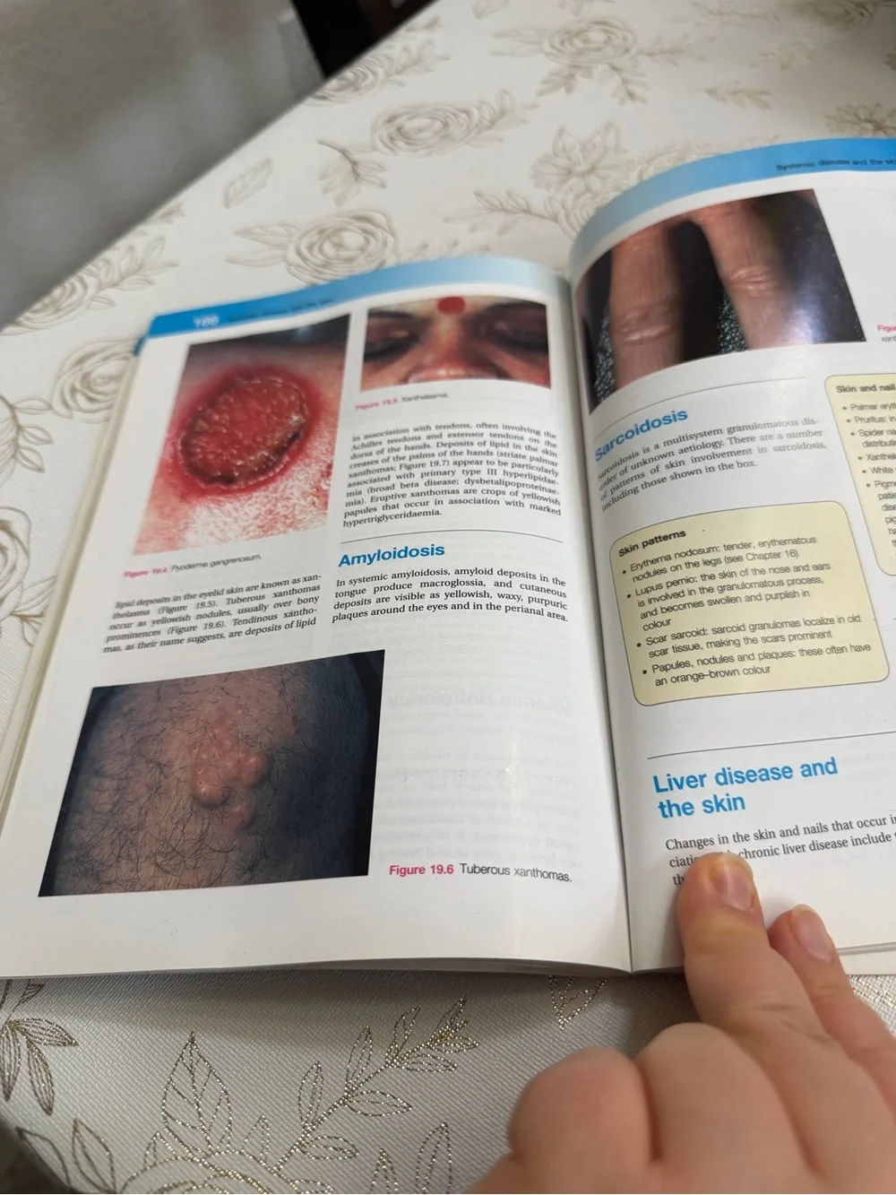 Lecture Notes: Dermatology (10th Edition) Paperback - Robin Graham-Brown & Tony